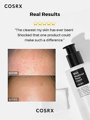 Cosrx - BHA Blackhead Power Liquid - Λοσιόν Για Μαύρα Στίγματα - 100ml