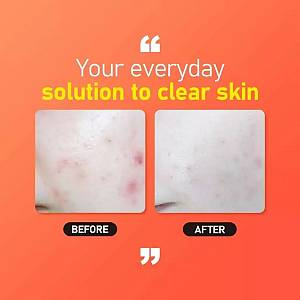 Jumiso All day Vitamin Brightening & Balancing Facial Serum – Λάμψη και εξισορρόπηση - 30ml