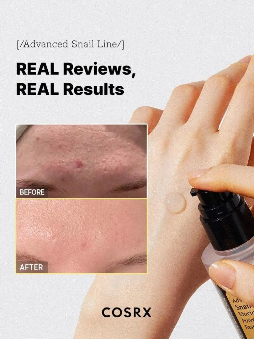 COSRX Advanced Snail 96 Mucin Power Essence- Ενυδατικό essence με βλεννίνη σαλιγκαριού - 100 ml