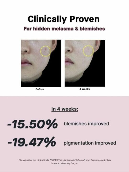 COSRX The Niacinamide 15 Serum – Ορός με νιασιναμίδη για καταπολέμηση της ακμής - 20 ml