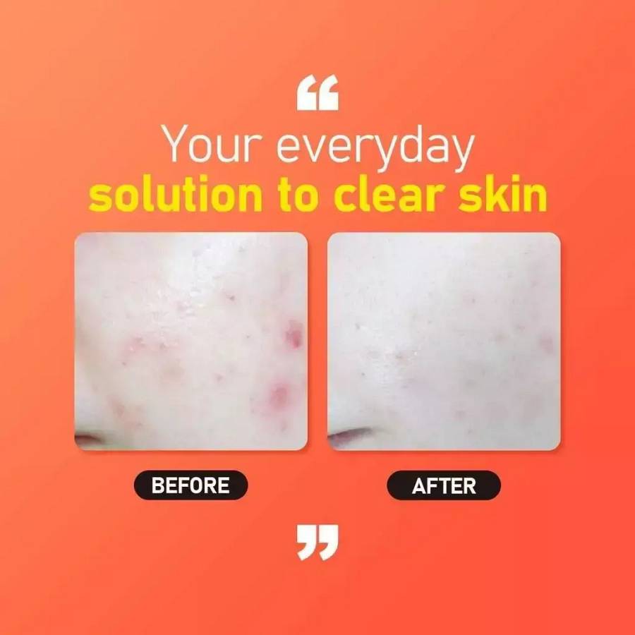 Jumiso All day Vitamin Brightening & Balancing Facial Serum – Λάμψη και εξισορρόπηση - 30ml